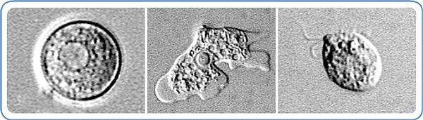 Мужчину положили в больницу, но врачи не смогли его спасти. Фабрицио скончался.