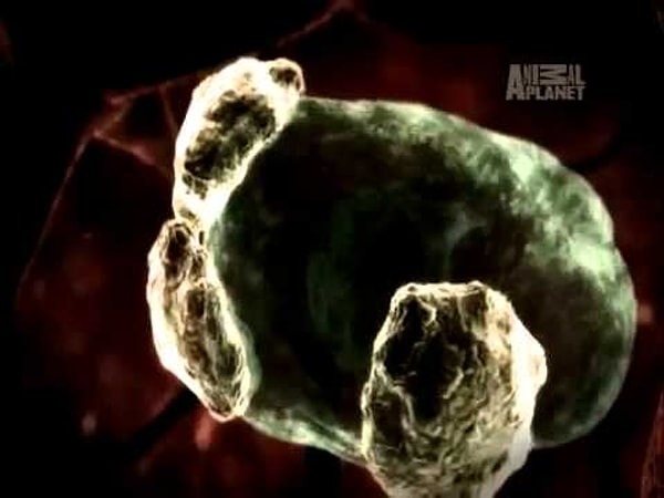 Результаты анализов показали, что на момент поступления в больницу Фабрицио страдал первичным амебным менингоэнцефалитом, смертность при котором составляет около 98%.