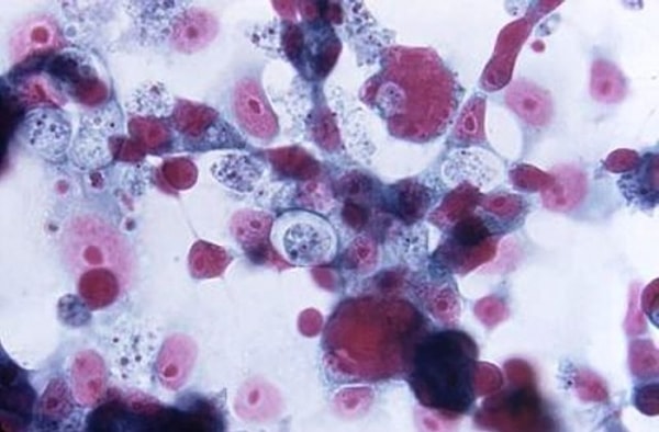 Бассейн, в котором Стабиле катался на доске, конечно, закрыли. Вода отправлена на лабораторную экспертизу.