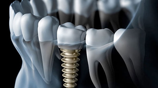 6. Выберите правильный вариант написания слова.