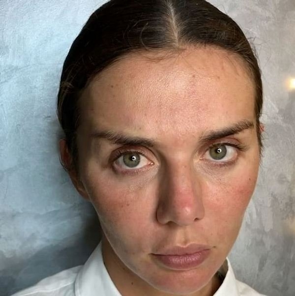 12. Анна Седокова, 35 лет