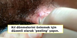 Can Sıkan Kıl Dönmelerini Önlemek ve Oluşanları Geçirmek İçin Bilmeniz Gerekenler