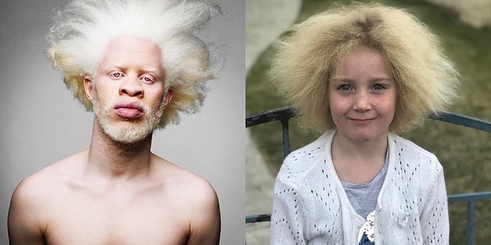 Çarpıcı ve Benzersiz Görünüşlere Sahip Oldukları İçin Ünlü Olan 15 Etkileyici İnsan