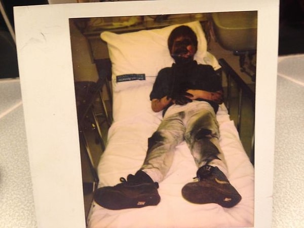 6. "В детстве я попытался разрубить топором баллончик с краской".