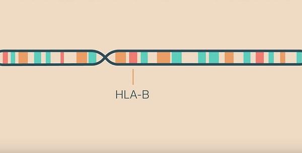 Sonradan anlaşıldı ki bu vakalar tesadüfi ortaya çıkmamıştı, bölgede yaşayan kadınların HLA B27 olarak adlandırılan geni mutasyona uğramıştı.