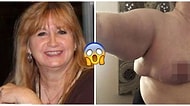 Ne Umdu Ne Buldu: Meme Küçültme Ameliyatı Olduktan Sonra Üçüncü Memesi Çıkan Kadın!