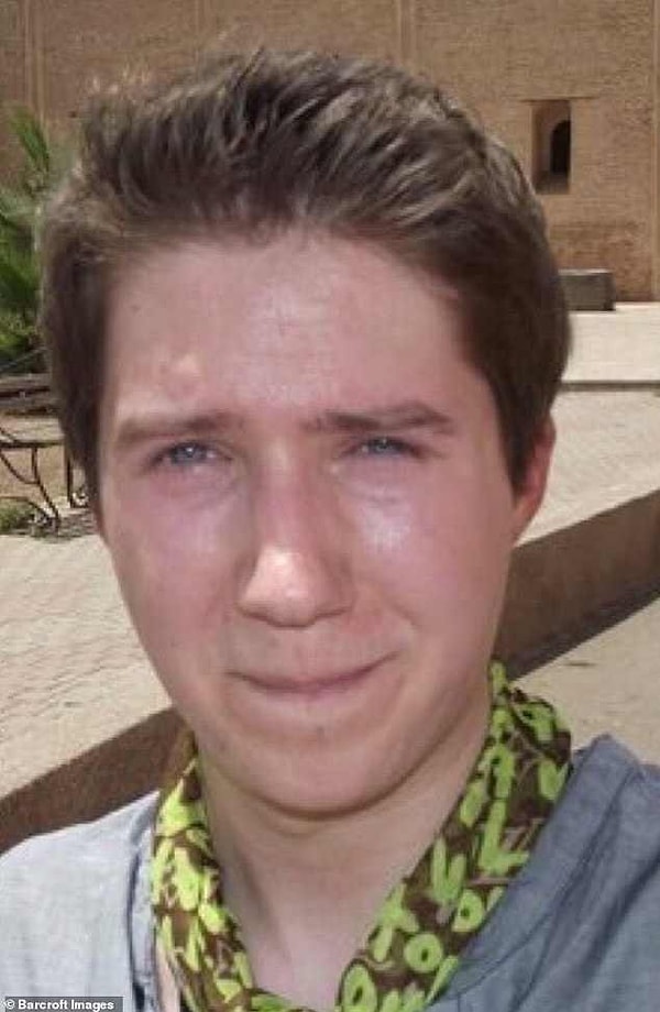 Именно тогда он впервые лег под нож хирурга в возрасте 23-х лет, сделав ринопластику.