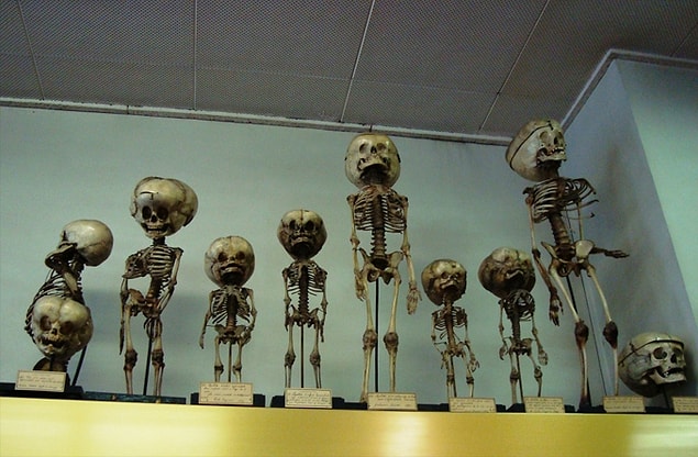 8. Musee Dupuytren - Anatomik Patoloji Müzesi
