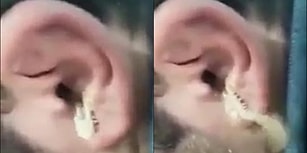 Kulağakaçan Efsanesi Gerçek Oldu! Bir Adamın Kulağından Devasa Boyutta Kırkayak Çıkartıldı