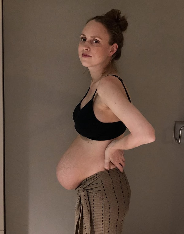 7. Одна неделя после родов 👇