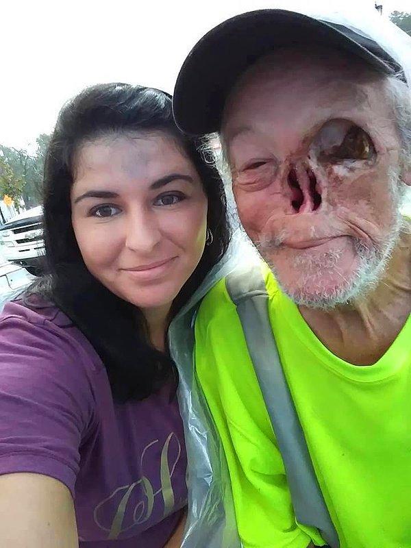 65 yaşındaki Kirby Evans, cilt kanserinden ötürü sol gözünü ve burnunun tamamını kaybetti.