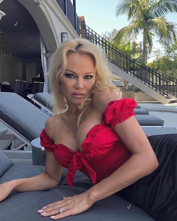 1. Pamela Anderson: Hepatit C