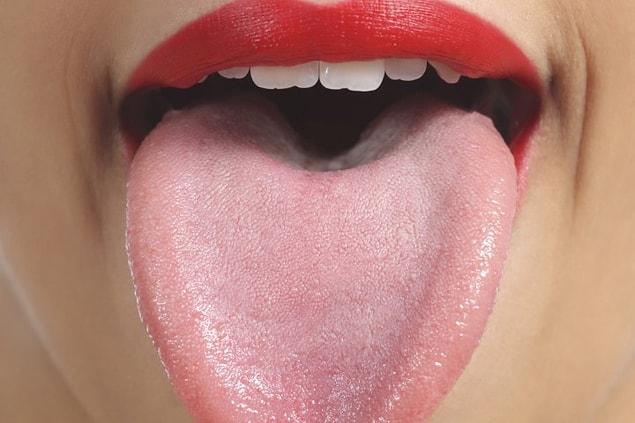 Dilinizin Rengi Sagliginiz Ile Ilgili Ne Gibi Isaretler Veriyor