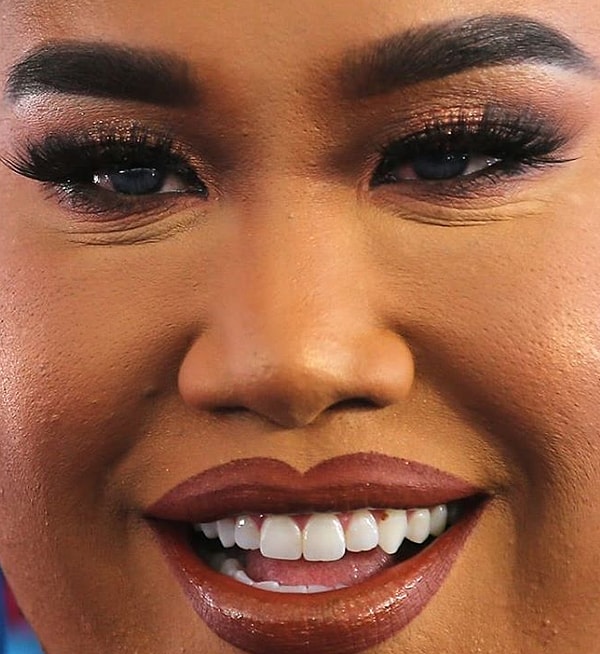 9. Но иногда лучше оставить все как есть, ну или, в конце концов, пойти за идеальными губами к хирургу и перестать выставлять себя не в лучшем свете. Как это делает Патрик Старр