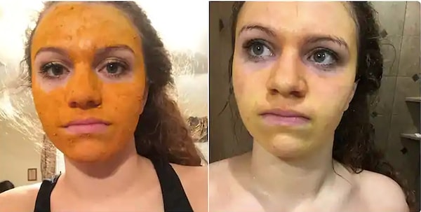 14. "Просто очищающая маска по рецепту из интернета. Ненавижу себя"