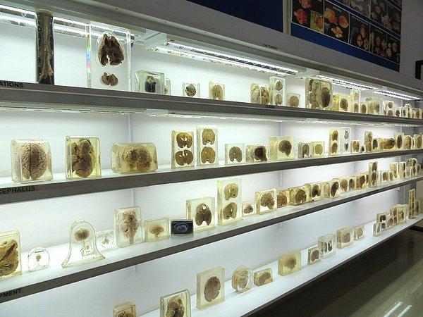 16. Beyin Müzesi (Peru)