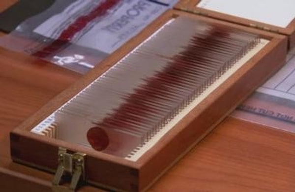 11. Эти образцы крови намекают на сериал...