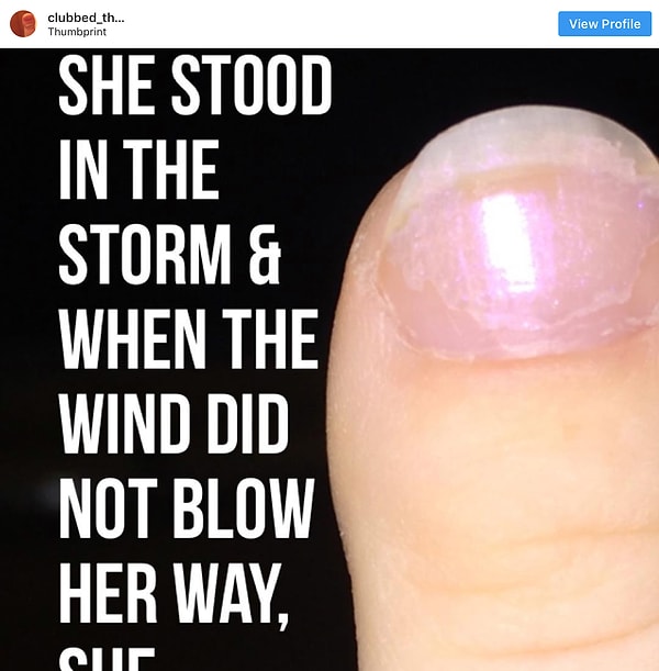 17. Но, несмотря на все это, ты понимаешь, что твои большие пальцы - это твоя изюминка...