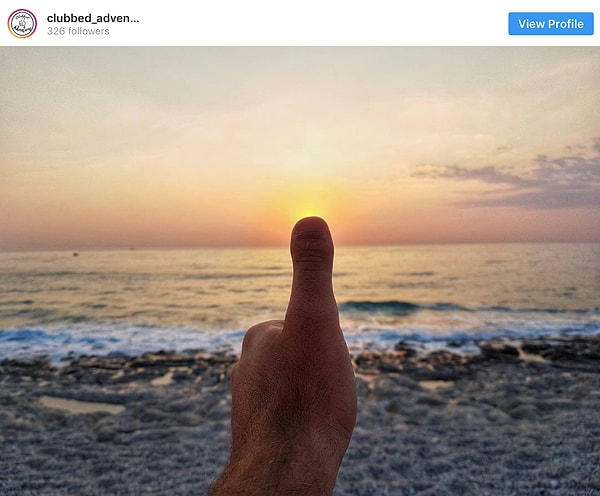 18. ... и она придает тебе уникальности!