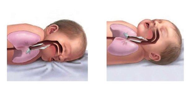 1. Bebeğinizi yüzüstü değil, sırtüstü ve kafası yan tarafa bakacak şekilde yatırın.