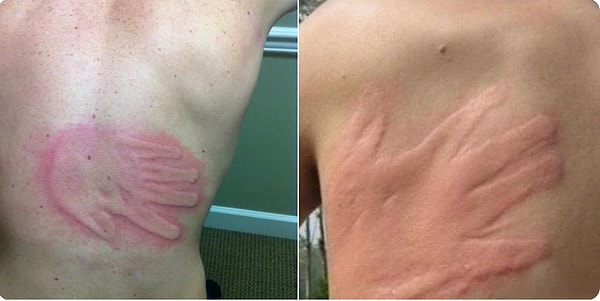 8. "Да я тебя слегка коснулся..."