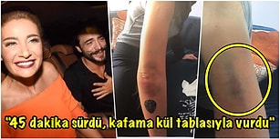 Şoktayız! Kıskanılan Aşkta Sona Gelindi: Ahmet Kural Sıla'yı Darp Etti!