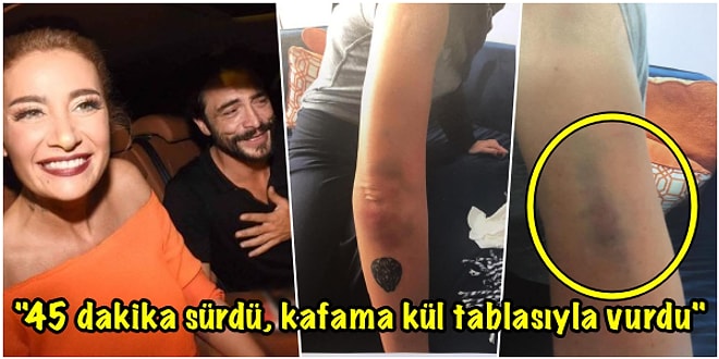 Şoktayız! Kıskanılan Aşkta Sona Gelindi: Ahmet Kural Sıla'yı Darp Etti!