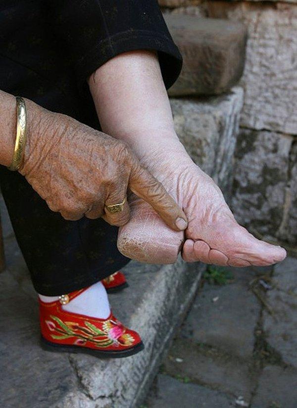9. Fotoğraftaki ayak ise Çin'de güzelliğin bir simgesi...