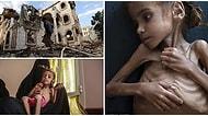 "Çocuklara Kıymayın Efendiler": 7 Yaşındaki Çocuğun Açlıktan Ölmesi Yemen'de Yaşanan İnsanlık Dramına Işık Tuttu!