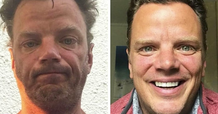 19 фотографий людей до и после того, как они завязали с алкоголем