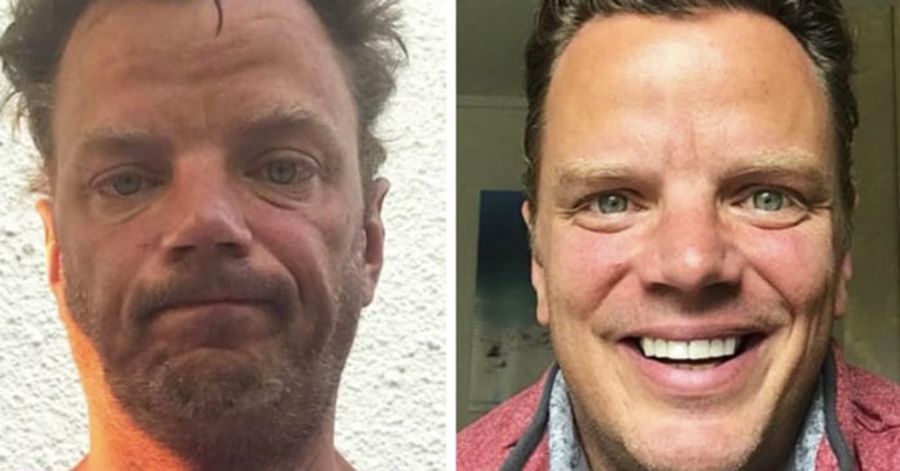 19 фотографий людей до и после того, как они завязали с алкоголем