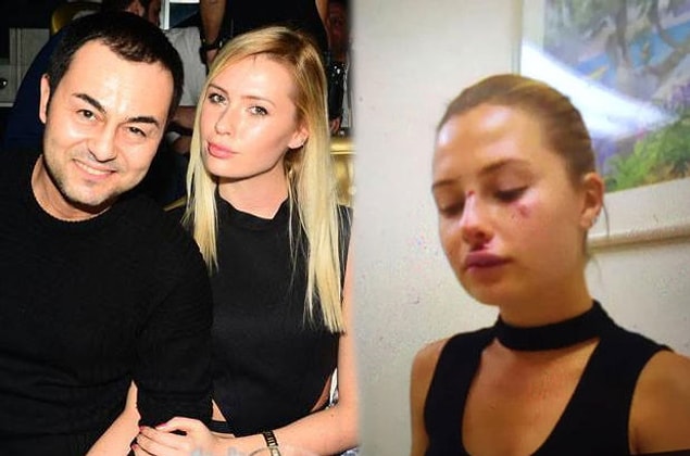 11. Serdar Ortaç'ın başından bela eksik olmayan bahtsız eşi Chloe ile ilgili bu hafta yine tuhaf iddialar ortaya atıldı. Yoksa şiddet mi var?!