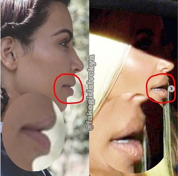 15. Эти звезды даже "правят" себе губы для фоточек!