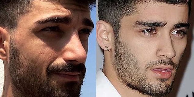 Son olarak burun estetiği yaptıran ve zayıflığı abartan İdo Tatlıses'in bu yeni hali dünyaca ünlü şarkıcı Zayn Malik'e benzetiliyor.