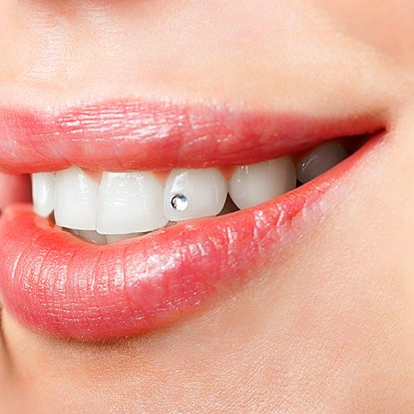 Diş modası denince akla 2000'lerde ikinci ya da üçüncü sıradaki dişe yapıştırılan minik taşlar geliyor.