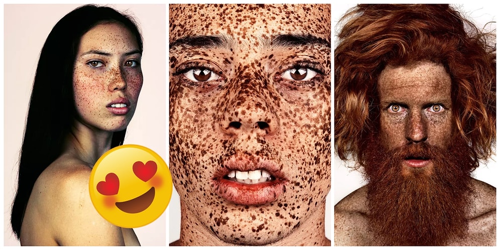 Çilli Olmanın Güzelliği! Farklılıklarıyla Kendilerine Hayran Kaldığımız 16 Sıra Dışı İnsan