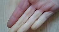 Sadece Raynaud Hastalığına Sahip Olanların Anlayabileceği İçinizi Soğutacak 16 Durum!