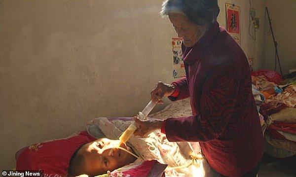 36 yaşındaki Wnag Shubao'nun, 2006 yılında geçirdiği kazadan sonra elleri ve ayakları felç olmuş.
