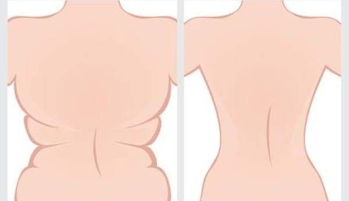 4 простых упражнения, которые помогут избавиться от жира на спине и в области подмышек