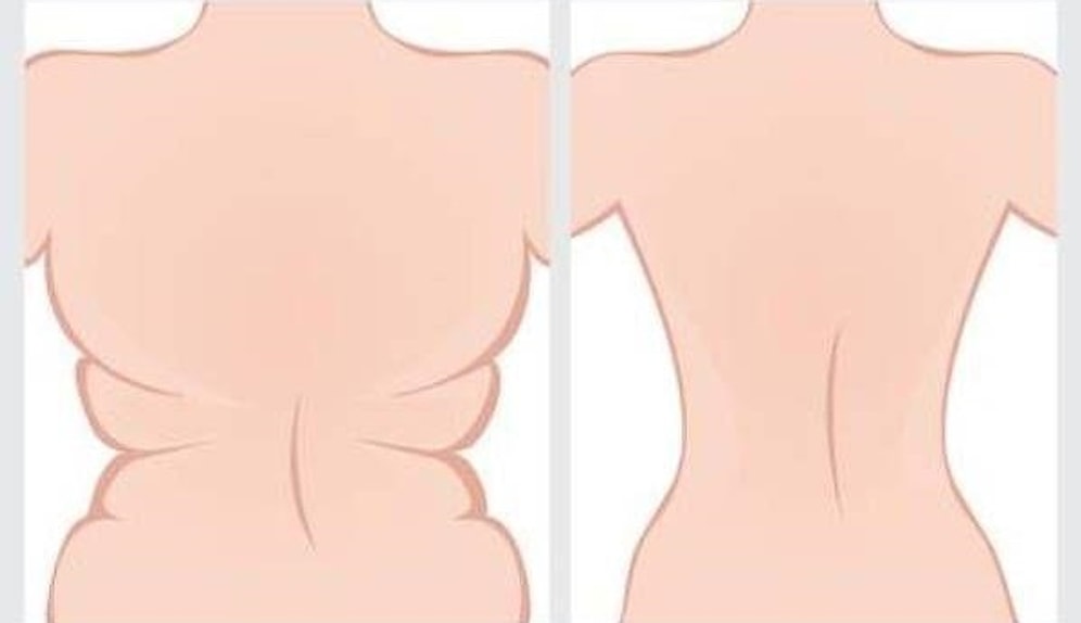 4 простых упражнения, которые помогут избавиться от жира на спине и в области подмышек