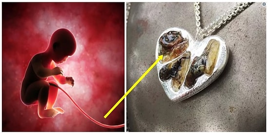 'Yok Artık!' Dediğinizi Duyar Gibiyiz! Annelerin Yeni Gözdesi, Bebeğin Göbek Bağından Yapılan Kolyeler