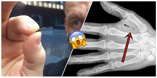 Bilim Kurgu Filmleri Gerçek Oldu: Birleşik Krallıktaki Büyük Firmalar, Çalışanlarına Mikroçip Taktıracak!