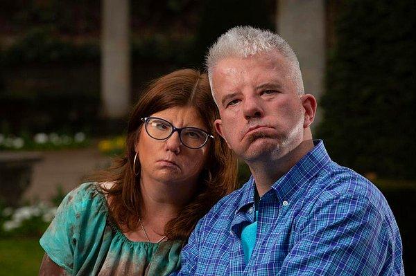 45 yaşındaki Alex Barker ve 38 yaşındaki Erin Smith, Moebius sendromuyla doğmuşlar.