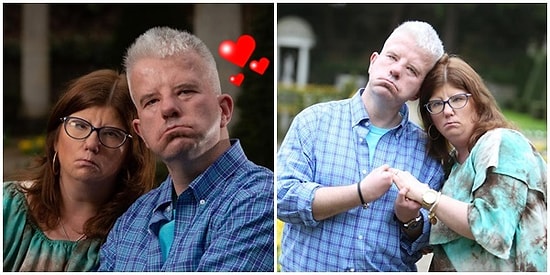 Hastalıkları Yüzünden Gülümseyemeyen Bu Çiftin Hikayesi Sizleri Aşkın Varlığına İnandıracak!