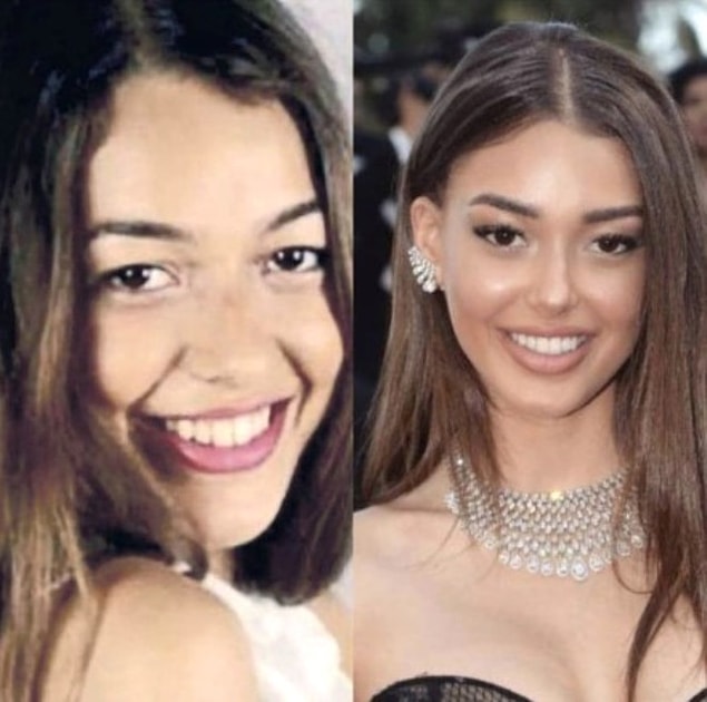 5. Dilan Çiçek Deniz