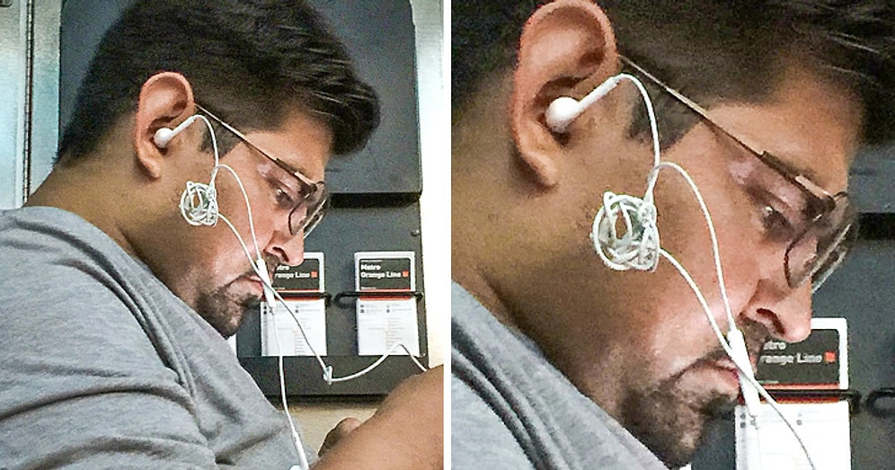 Görünce Tüylerinizi Diken Diken Etmekle Kalmayıp Midenizde Ekşimelere Sebep Olacak 24 Fotoğraf