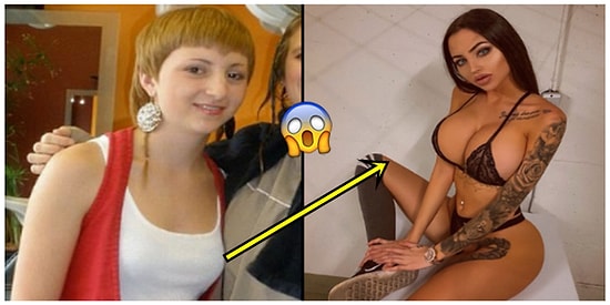 'Çirkin Ördek Yavrusu' Diye Dalga Geçildiği İçin Estetik Ameliyatlarla Bambaşka Biri Haline Dönüşen Kadın!