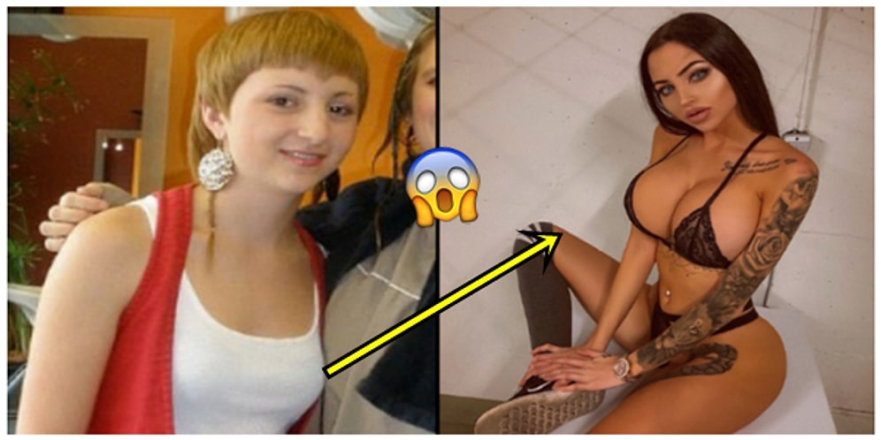 'Çirkin Ördek Yavrusu' Diye Dalga Geçildiği İçin Estetik Ameliyatlarla Bambaşka Biri Haline Dönüşen Kadın!