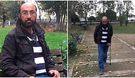Genç Kızın Erkek Arkadaşıyla Kavga Ettiği Sırada Kendisini Görüp 'Maymuna Benziyor' Demesi Yüzünden Hayata Küsen Adam