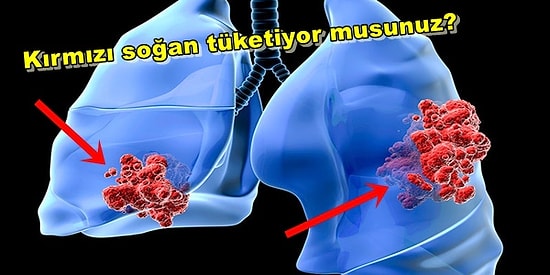 Akciğer Kanseri Riskini En Aza İndirebilmek İçin Uygulamanız Gereken 15 Önemli Tavsiye